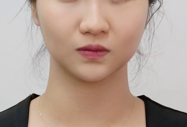 after 이미지