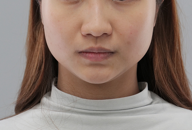 before 이미지