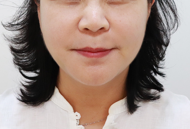 after 이미지