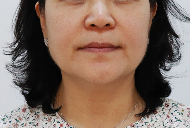 before 이미지