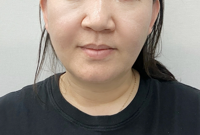 after 이미지