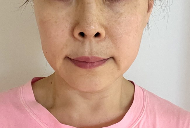 before 이미지