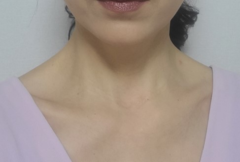after 이미지