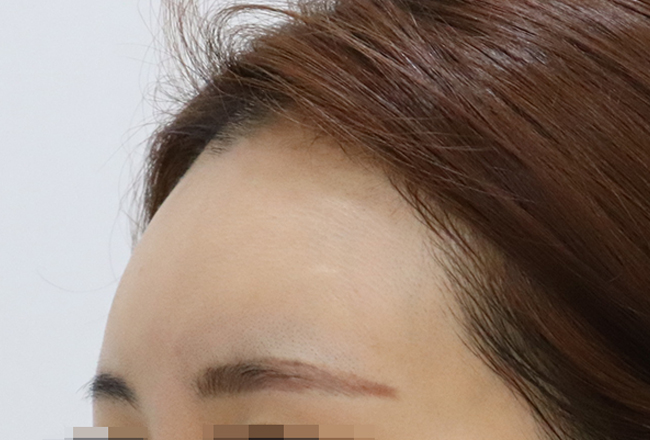 before 이미지