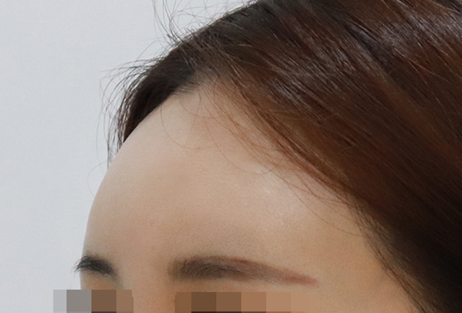 after 이미지