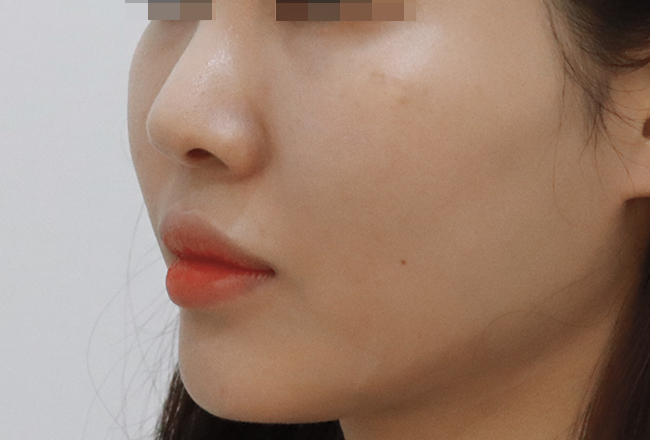 after 이미지