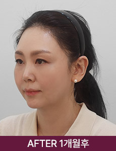 after 이미지