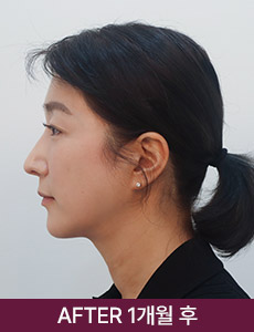 after 이미지