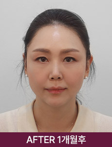 after 이미지